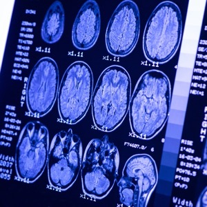 Team Jack tweet media