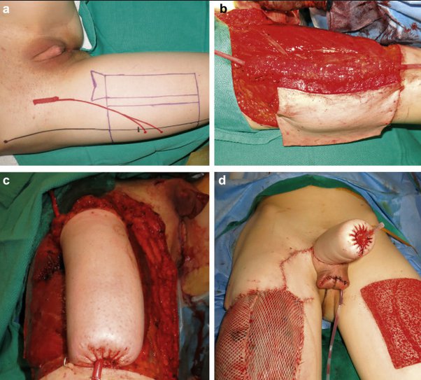 Andrew Zywiec, M.D. tweet media