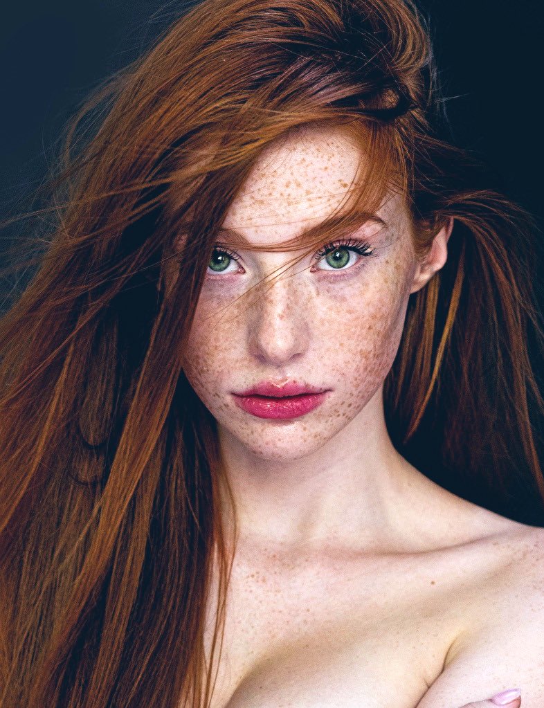 FreckledFace🧡 tweet media