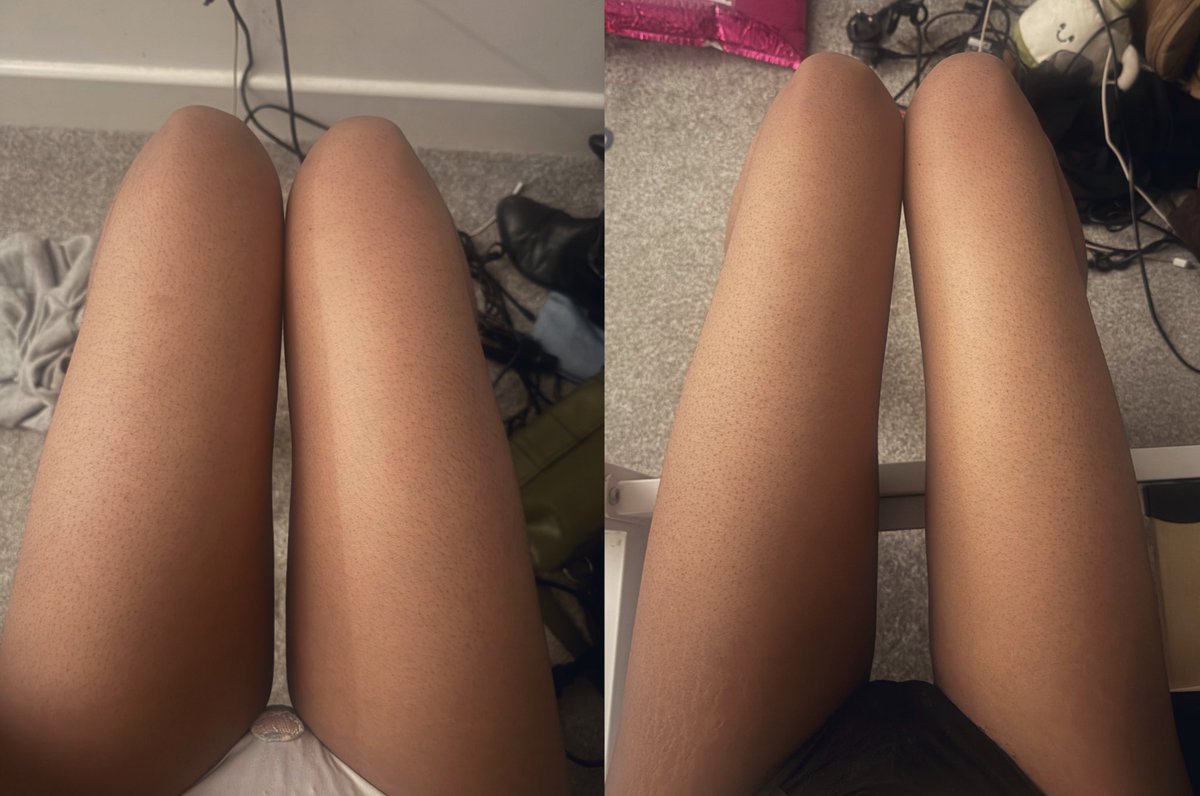 imgoinginsane tweet media