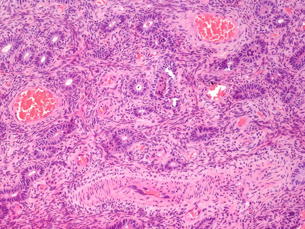 Charlie Herndon tweet media