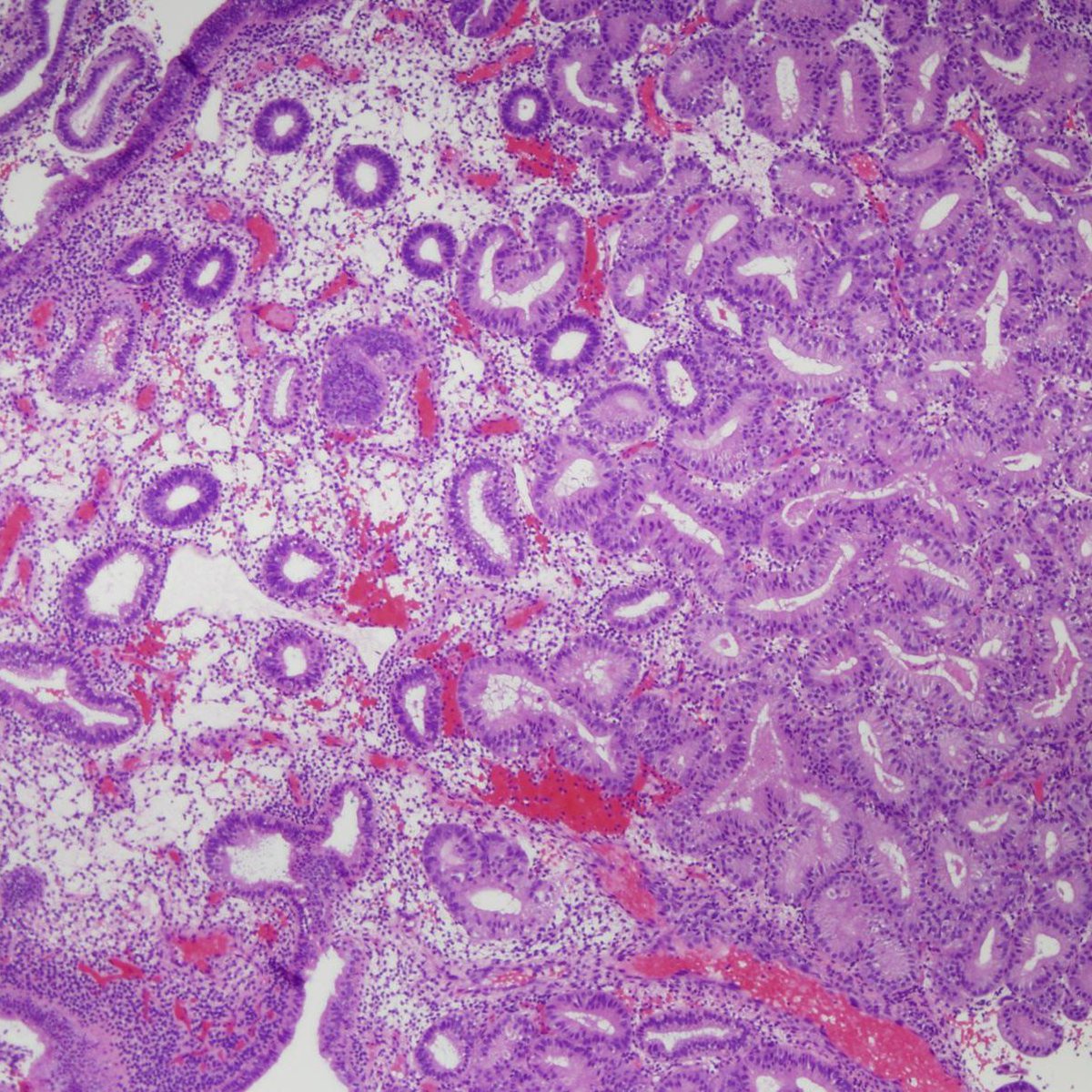 Charlie Herndon tweet media