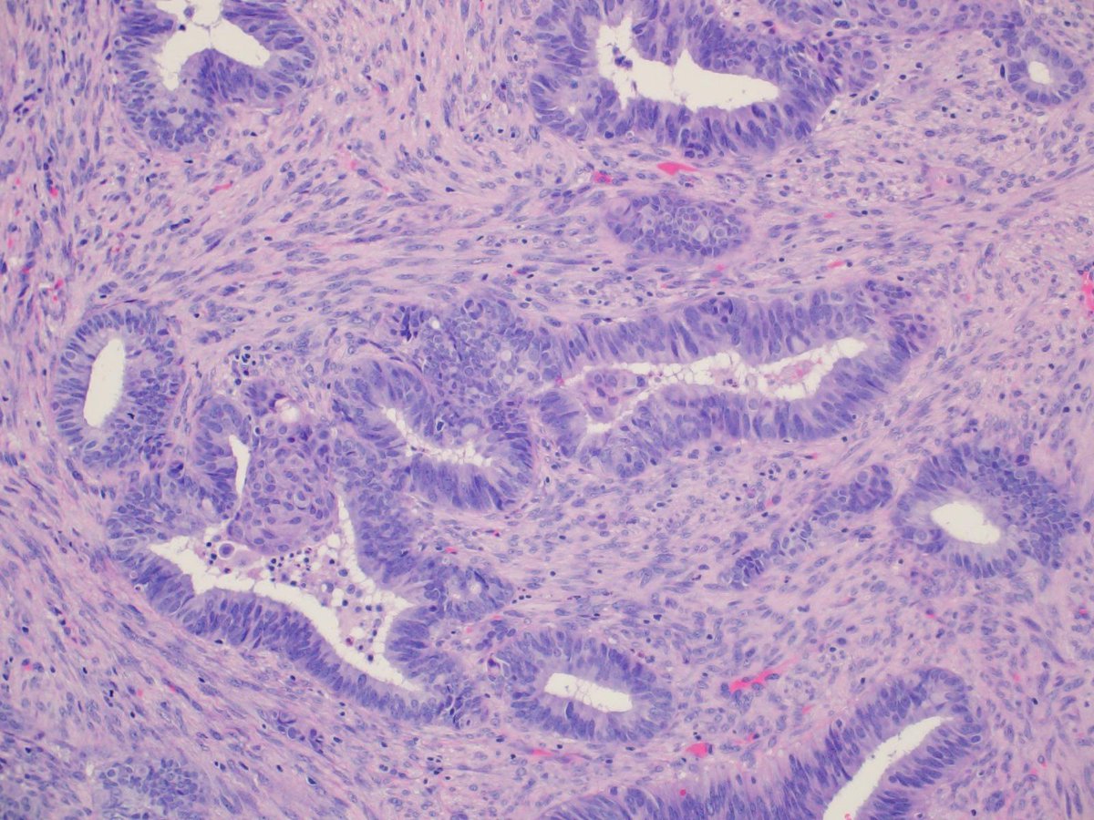 Charlie Herndon tweet media