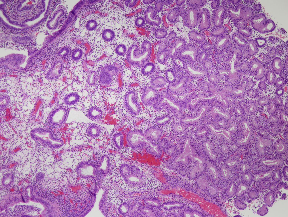 Charlie Herndon tweet media