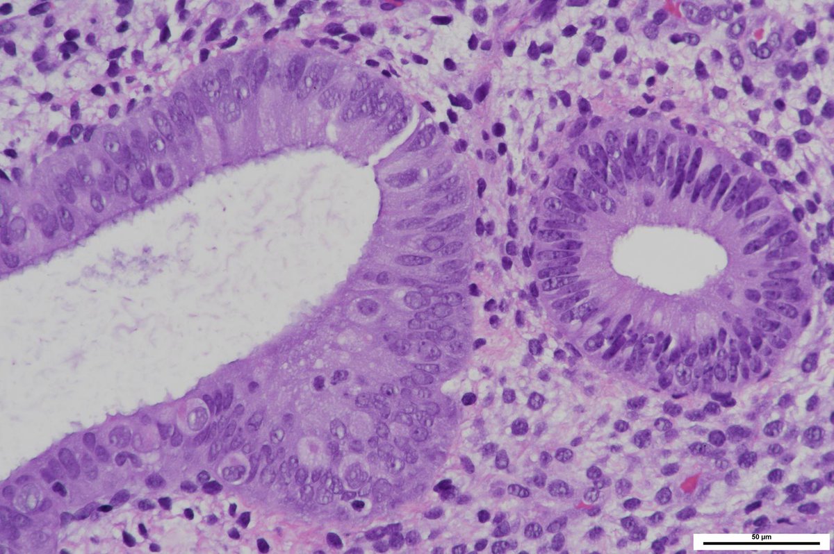 Charlie Herndon tweet media