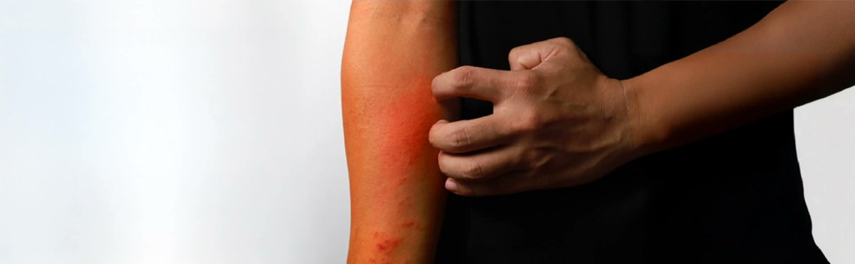 TodoDermatitis tweet media