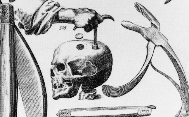 Magic Talking Skull tweet media