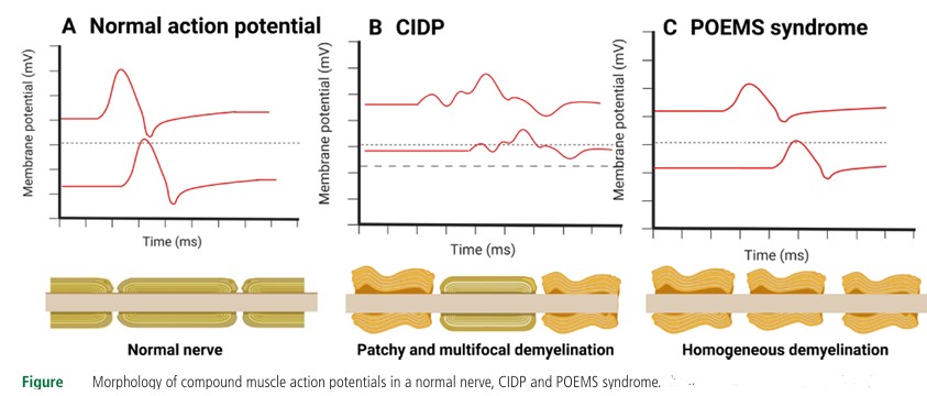 Journal of Neurology, Neurosurgery and Psychiatry tweet media