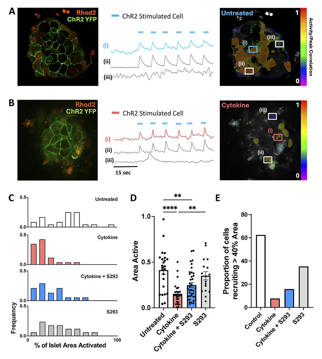 JGenPhysiol's tweet photo. Claire H. Levitt, Richard K.P. Benninger et al. @CUAnschutz investigate how loss of #GapJunctions under diabetogenic environments and their protection influence subpopulations of #insulin-producing β-cells https://t.co/qSkMCczxUp
#Diabetes https://t.co/JdawJGIyh0