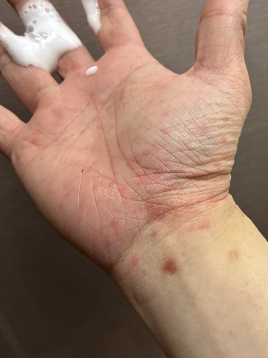 おみはるの雑垢 tweet media