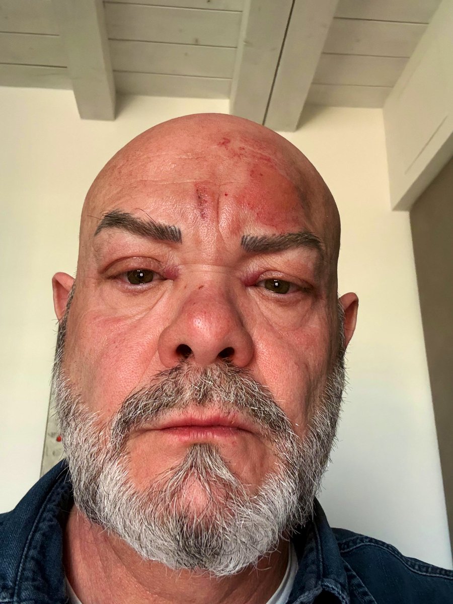 Rudi De Fanti tweet media