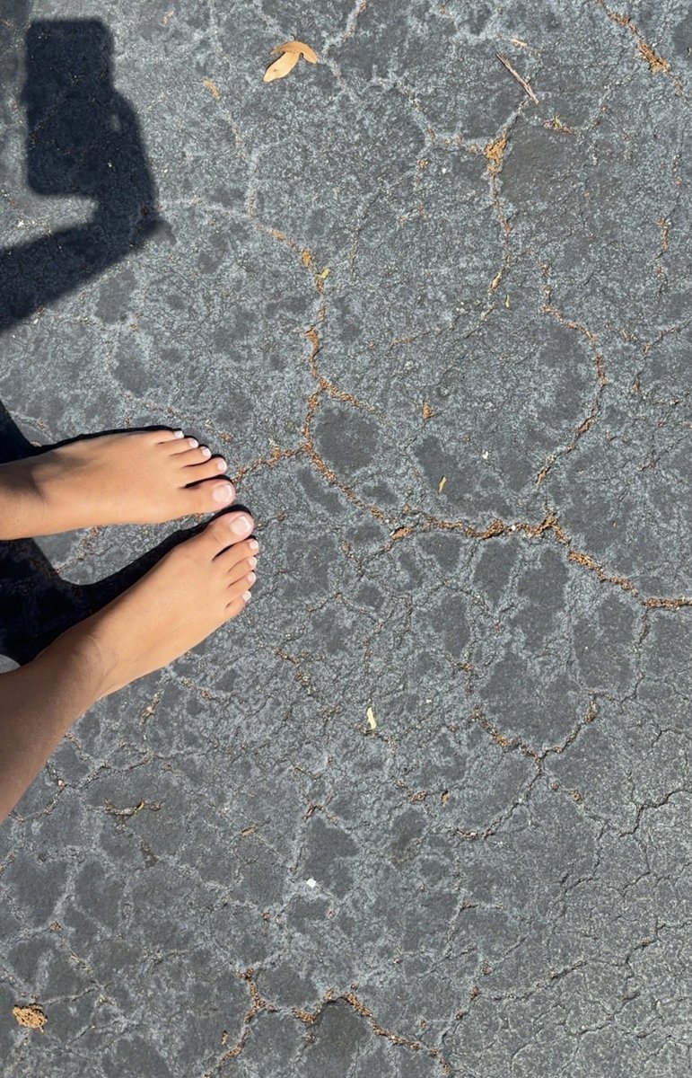 Freckles tweet media