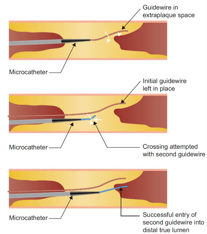 Journal of Invasive Cardiology tweet media