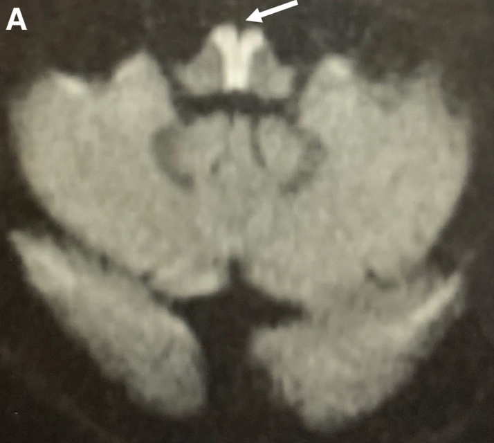 Braydon Dymm, MD tweet media