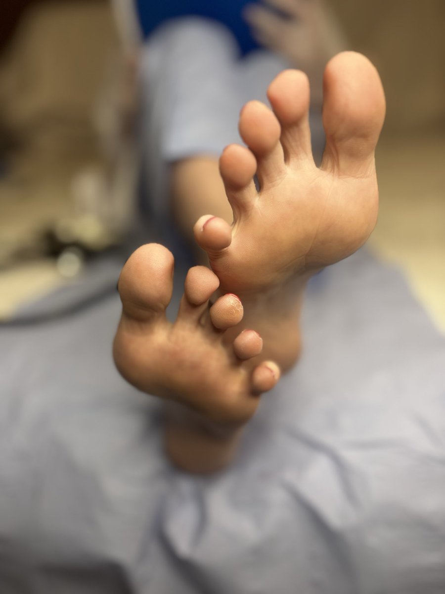 DrFootsyFox's tweet photo. Patients roll boom in your appointment. Get your prescription for foot worship on my OF now. A discount for you first few subscribers. The doctor is in the house 

#MedicalFootFetish #DoctorFeet #PodiatristFetish #FootFetish #Feet #FeetLovers #Podiatry https://t.co/cHKbhhS1Tc