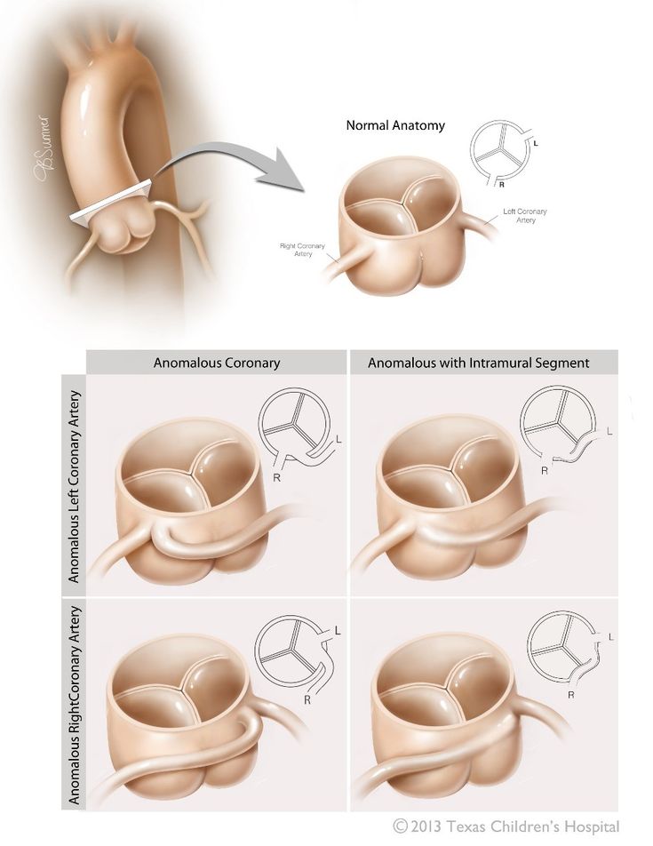 Ahmedata7777's tweet photo. Anomalous Aortic Origin of the Coronary Arteries https://t.co/RGsic6bPIO