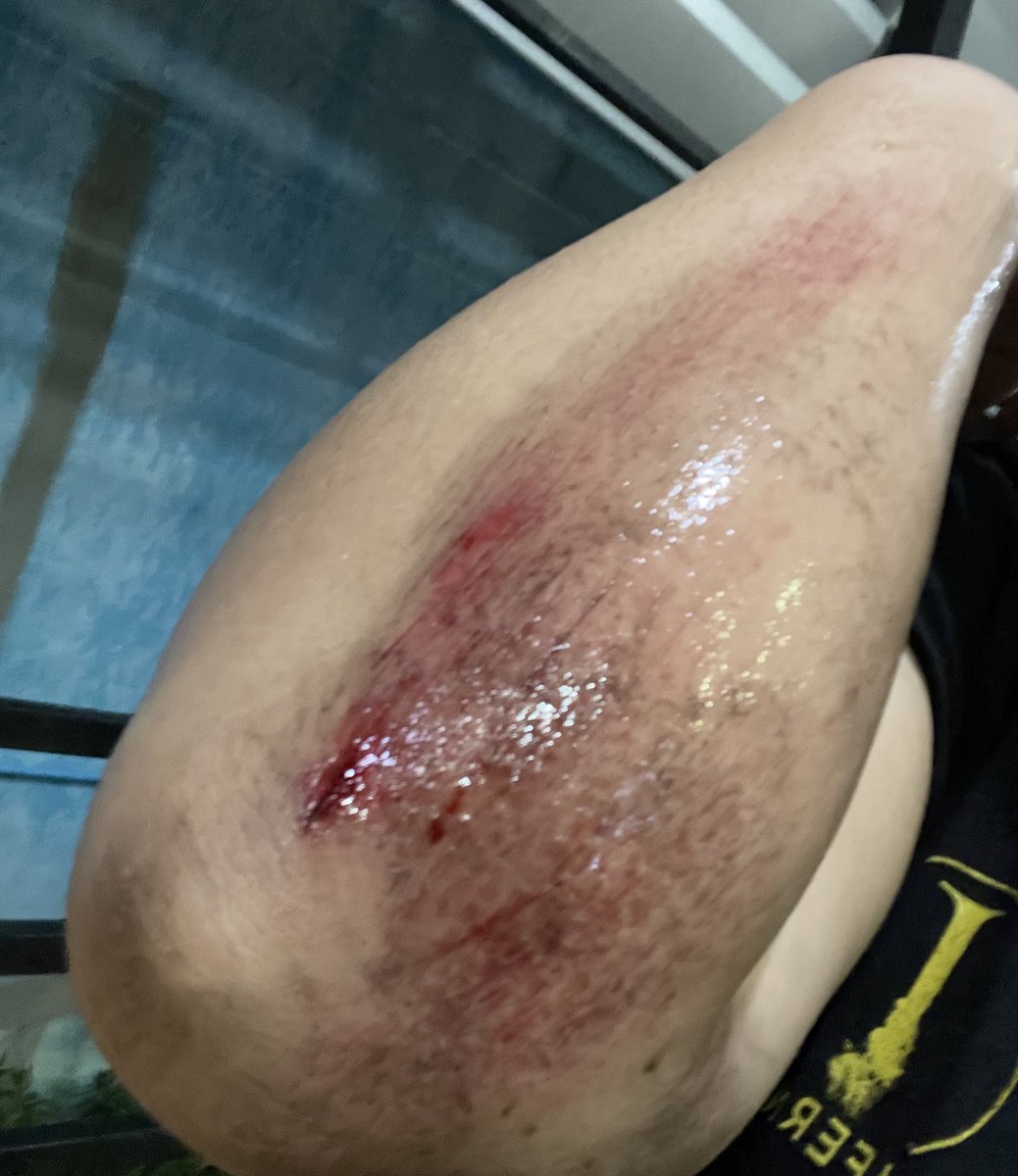 blackmood tweet media