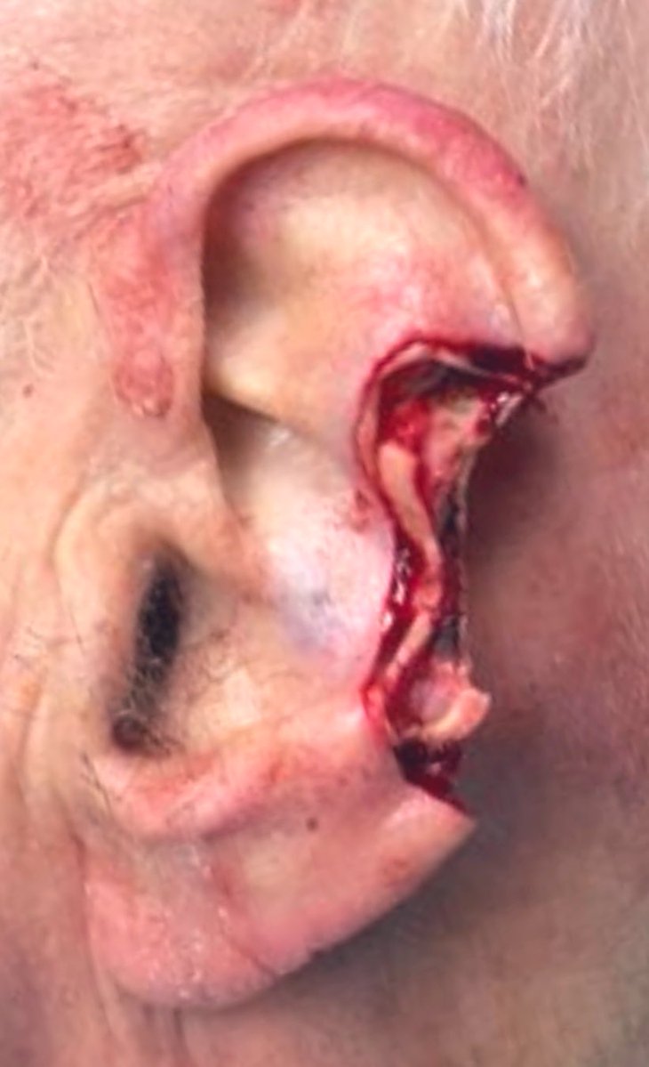 The Surfing CyberSurgeon©️ 🔪 🏄♂️🤙 ☮️ tweet media