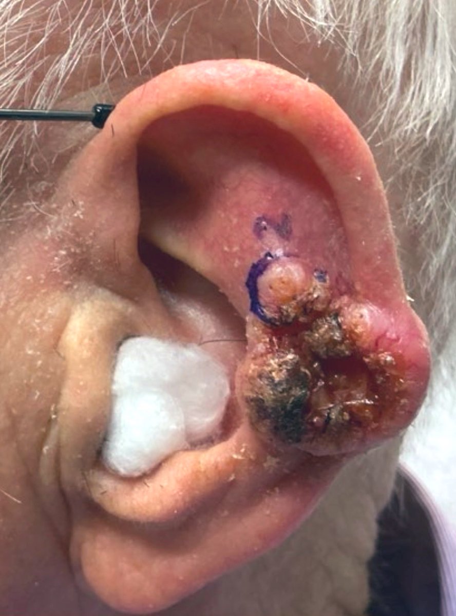 The Surfing CyberSurgeon©️ 🔪 🏄♂️🤙 ☮️ tweet media