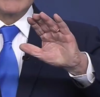 FoxAyman's tweet photo. @RothLindberg I found my own artifact... By sheer magic, the ring moves from just about over the joint to at the base of the finger... Hilarious, actually. https://t.co/JEYudYtOhB