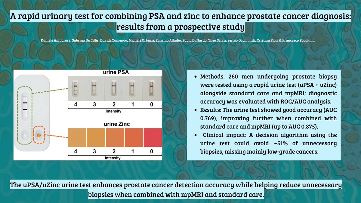 pcan_journal's tweet photo. 🧪🚀 A new uPSA/uZinc urine test shows promise in prostate cancer detection:
✔️ Improves diagnostic accuracy (especially with mpMRI)
✔️ Could avoid ~50% of unnecessary biopsies
🔍 A step toward smarter, non-invasive, personalized care! 
🔗https://t.co/w7YgeikJ3V https://t.co/zLrGO2sCYF