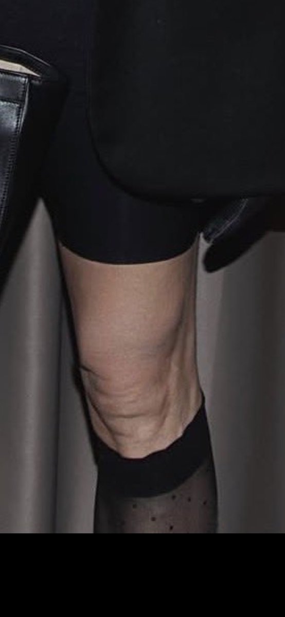 𝗠𝗶𝗹𝗼𝘀 tweet media