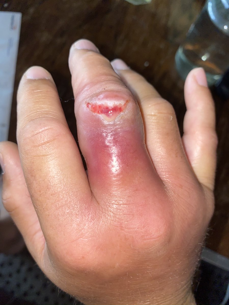 Peter Bonner tweet media