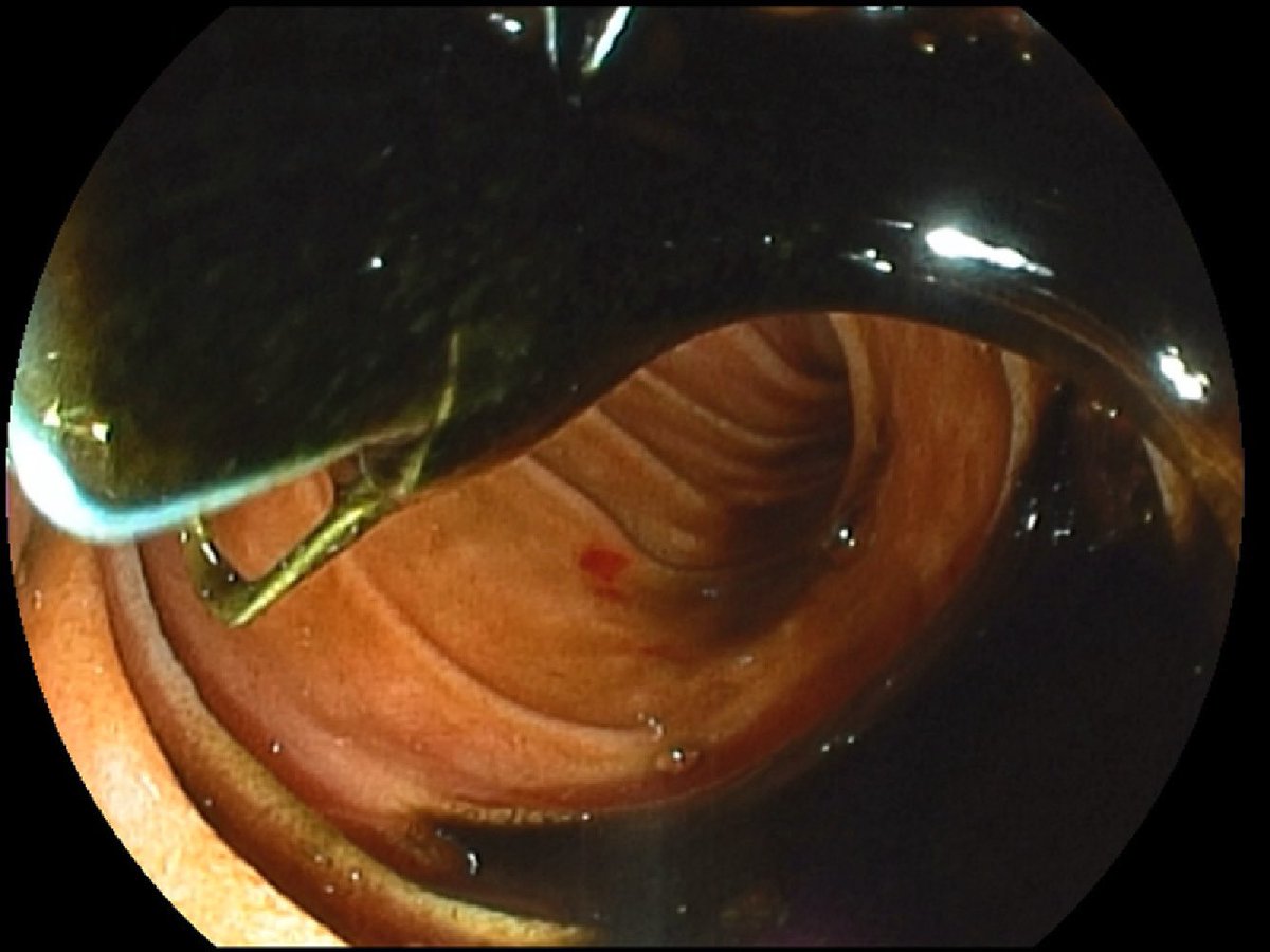 Keith Siau tweet media