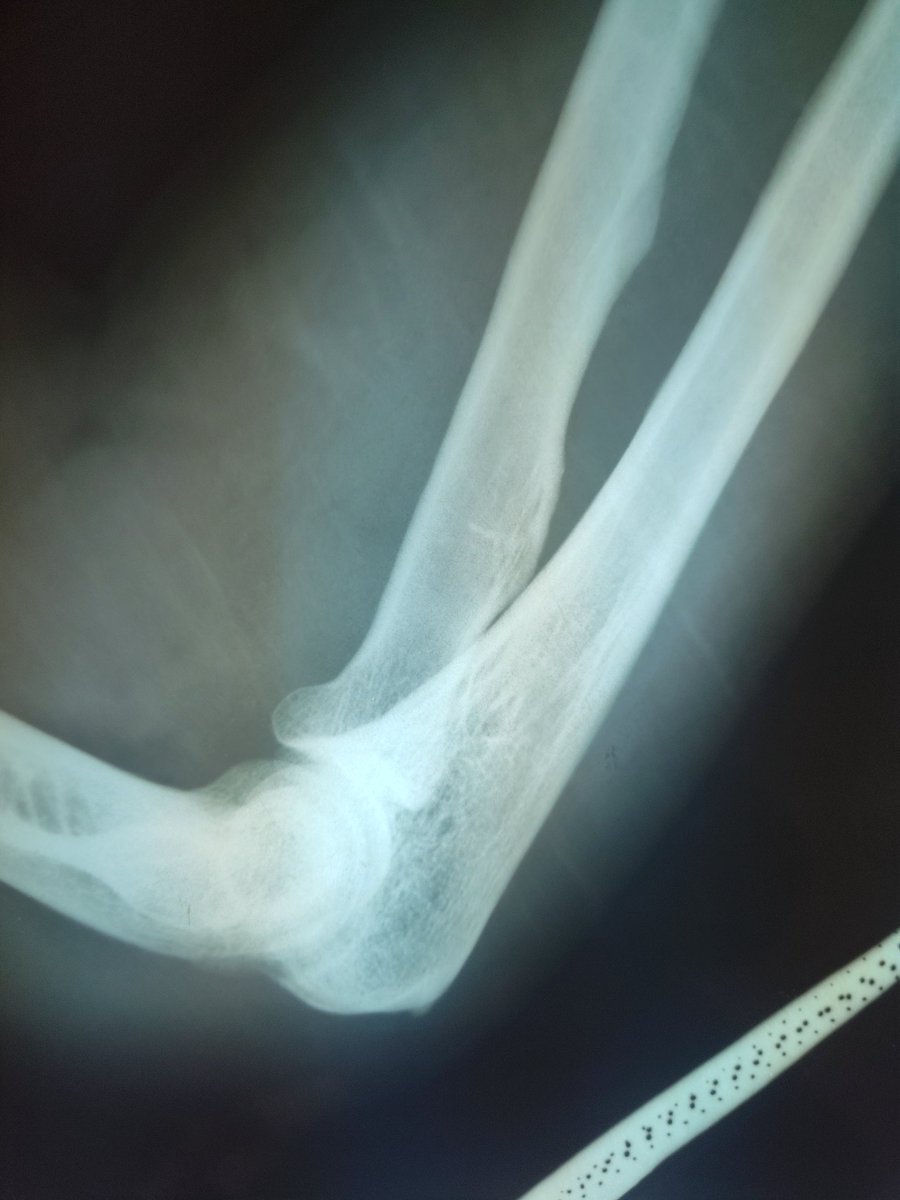 HaitianHODL tweet media