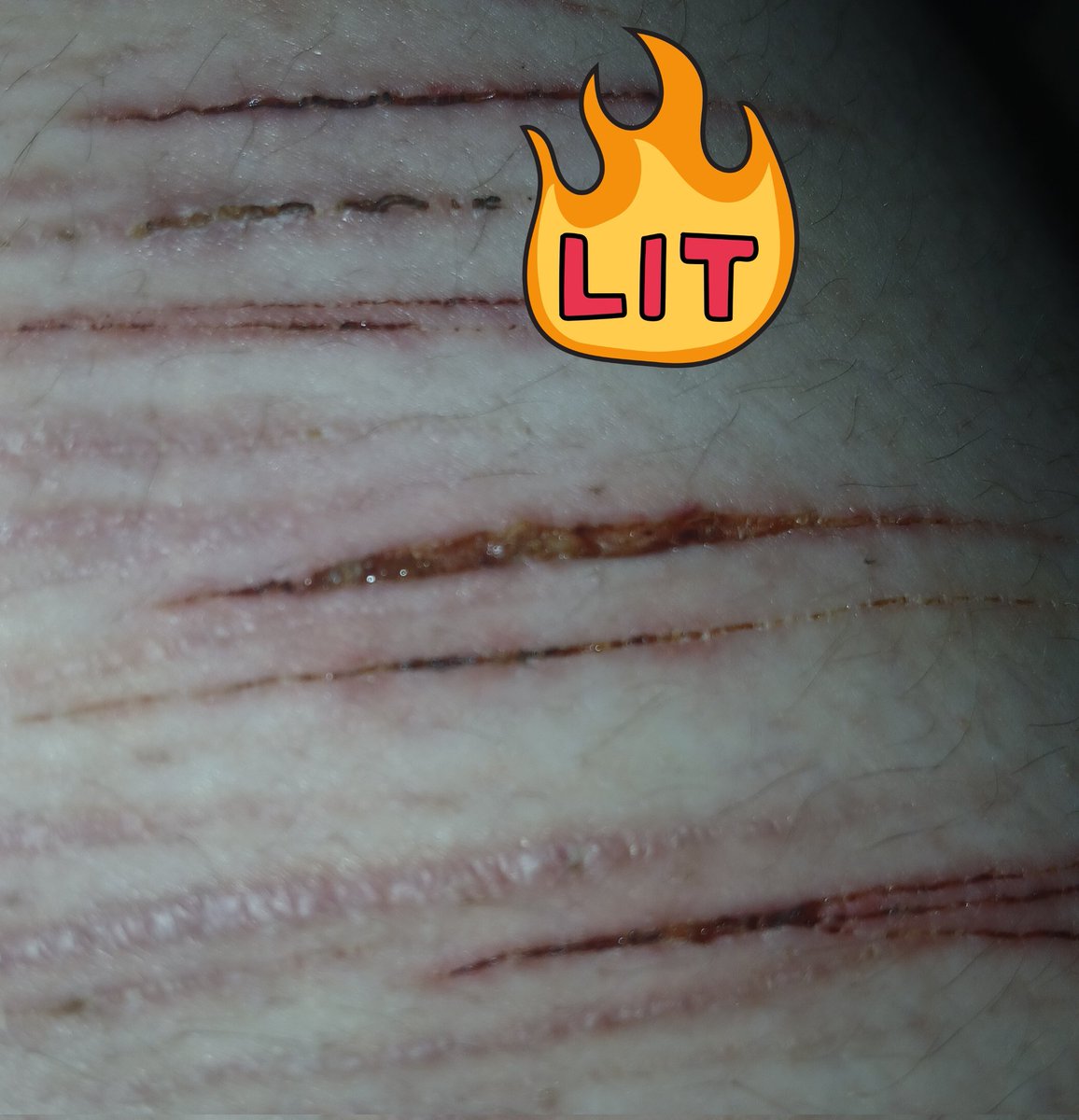 eve ⛑️🔪/🚸✂️ (SHEDTWT) tweet media