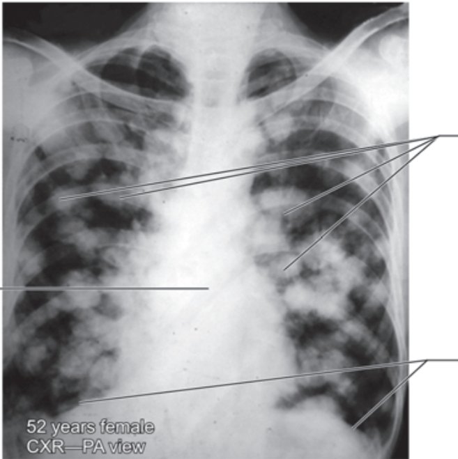 Naseem Suhail, MD tweet media