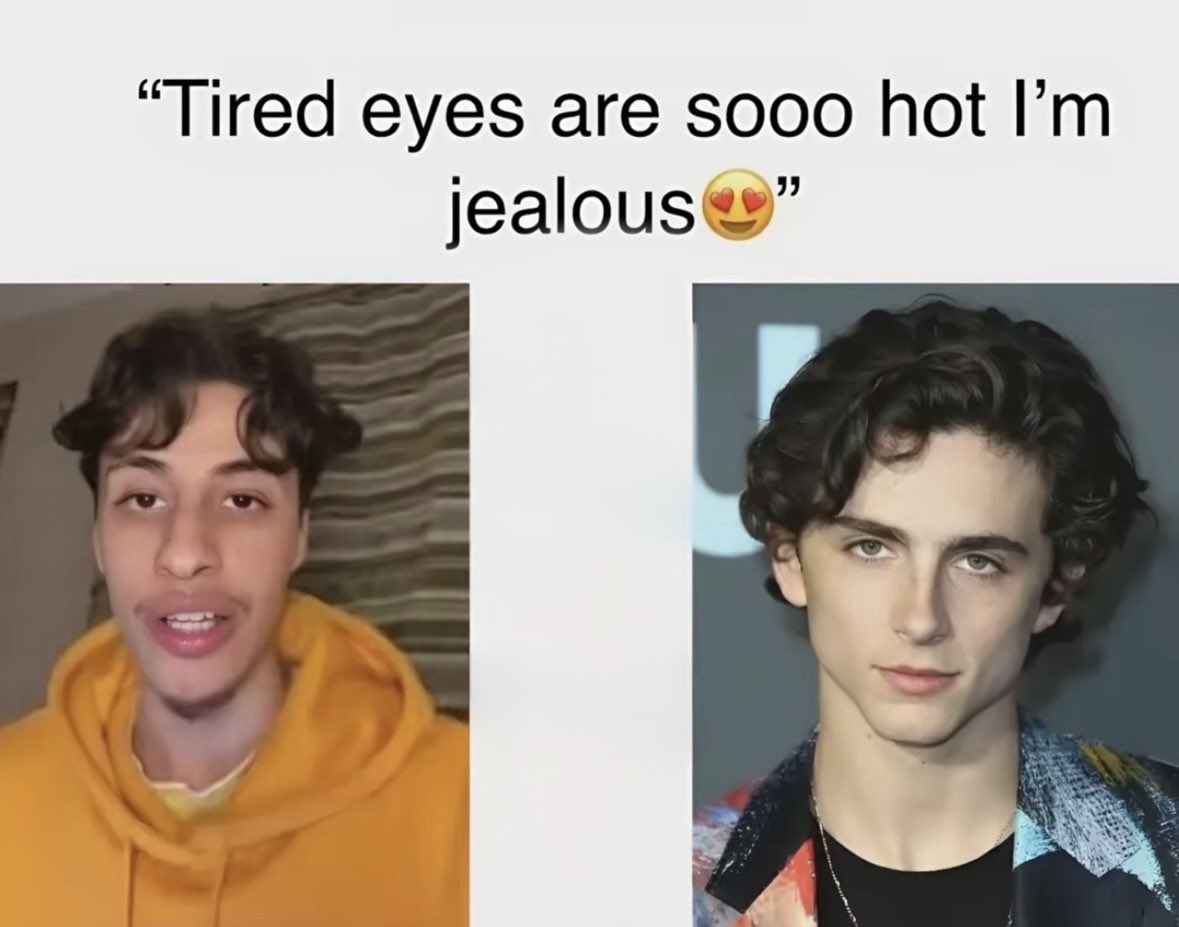 They love ‘tired eyes’ as long as you’re Timothée Chalamet