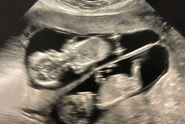 Louise Ivan tweet media