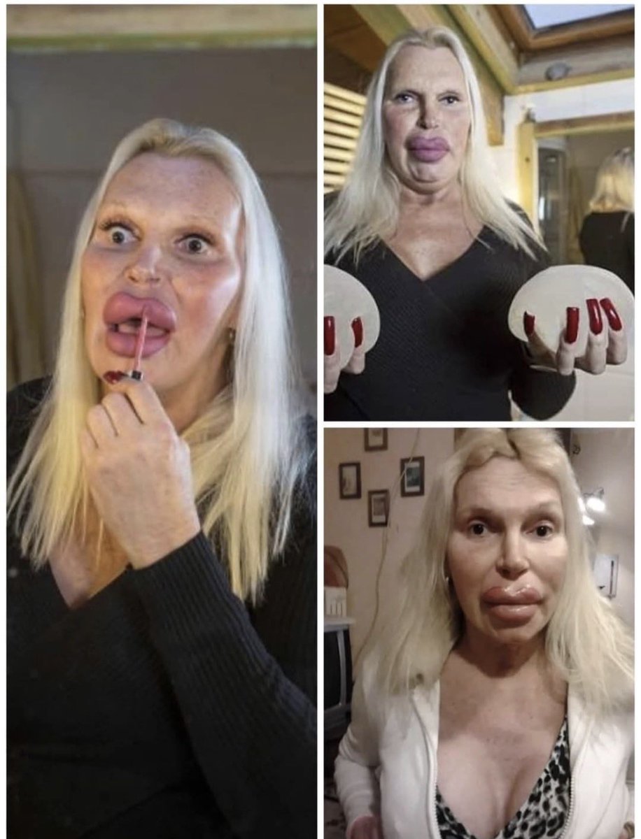 𝐑𝐄𝐃 𝐊𝐄𝐍 🏴󠁧󠁢󠁥󠁮󠁧󠁿🇬🇧 tweet media