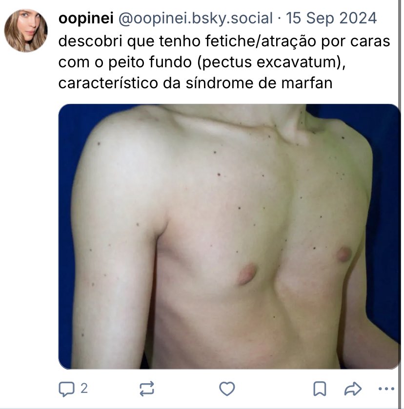 maxilohit tweet media