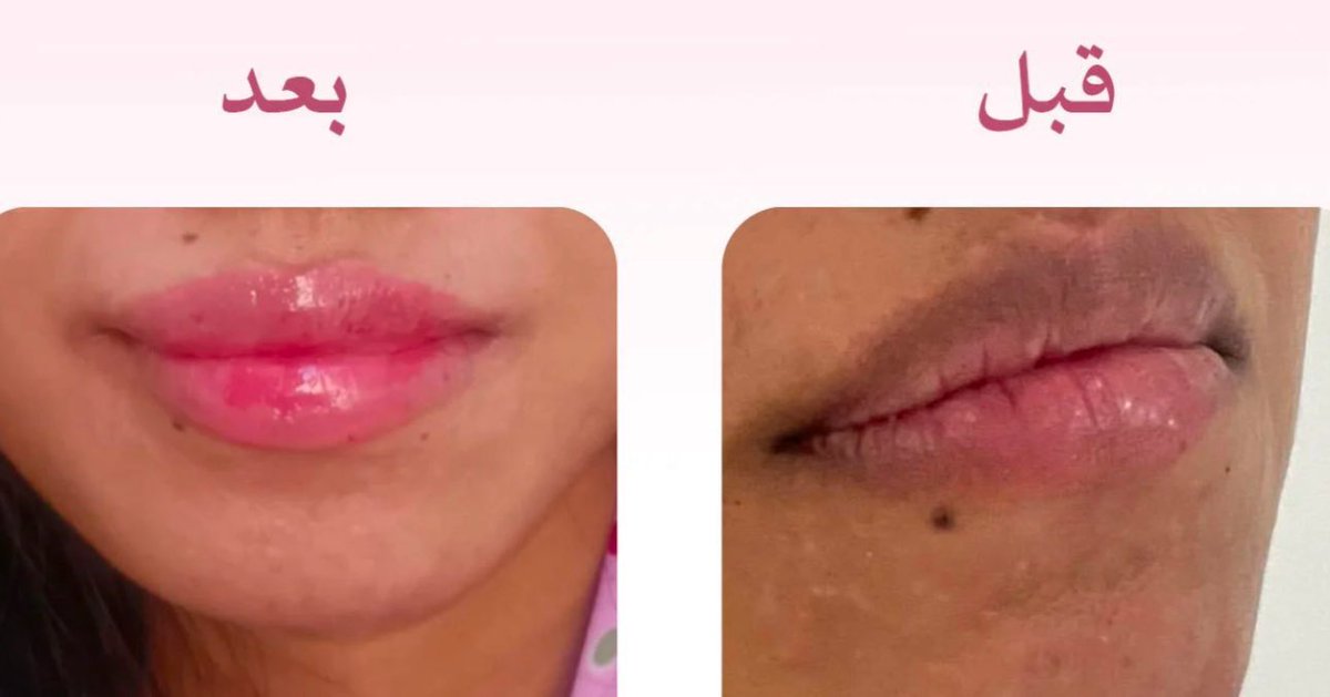 sara كود ماي الورد ( ASI ) tweet media