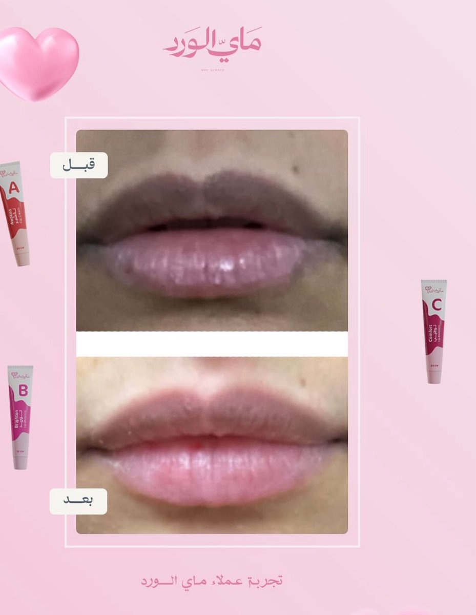 sara كود ماي الورد ( ASI ) tweet media