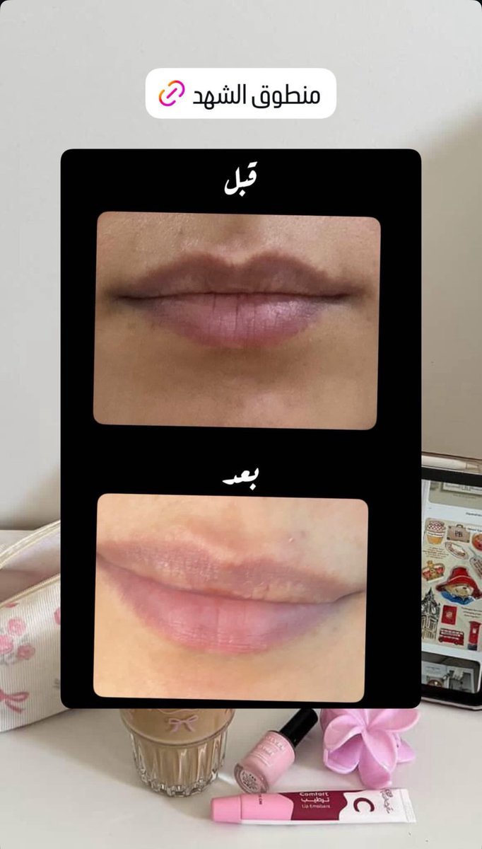 sara كود ماي الورد ( ASI ) tweet media