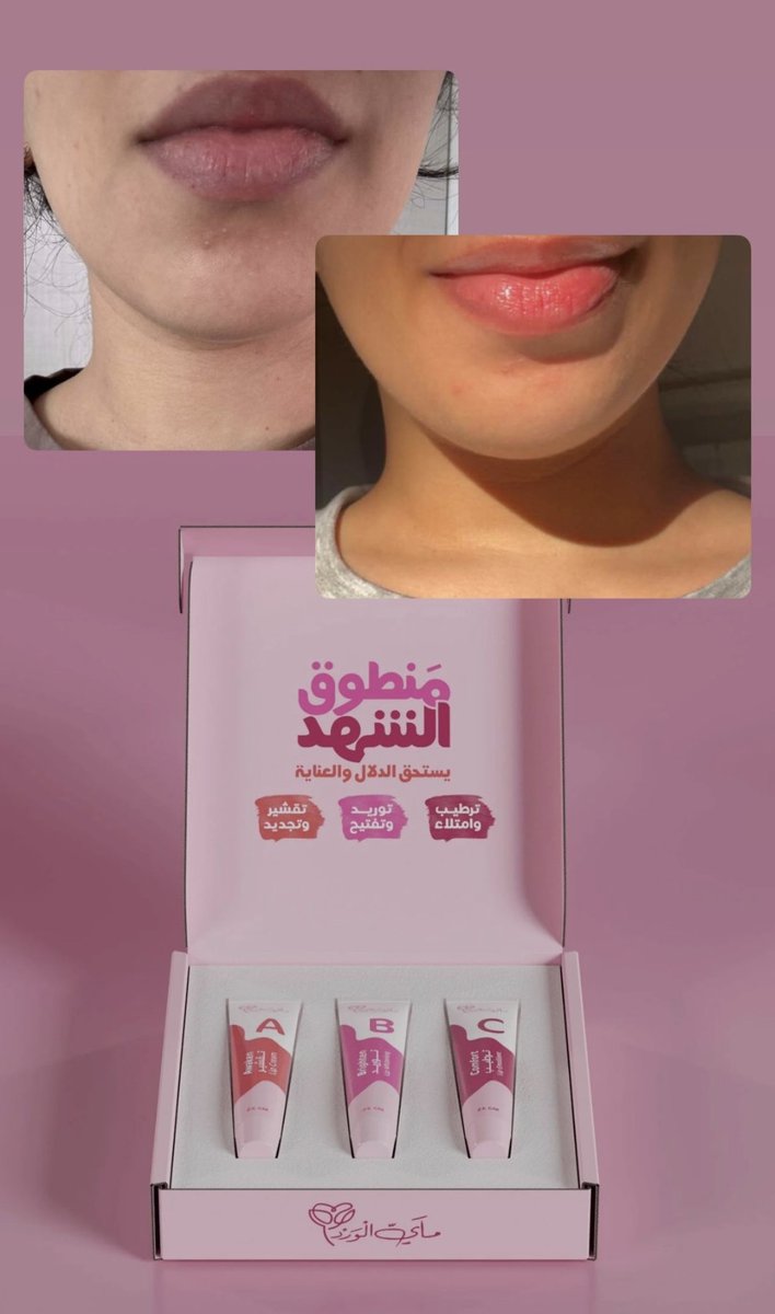 sara كود ماي الورد ( ASI ) tweet media