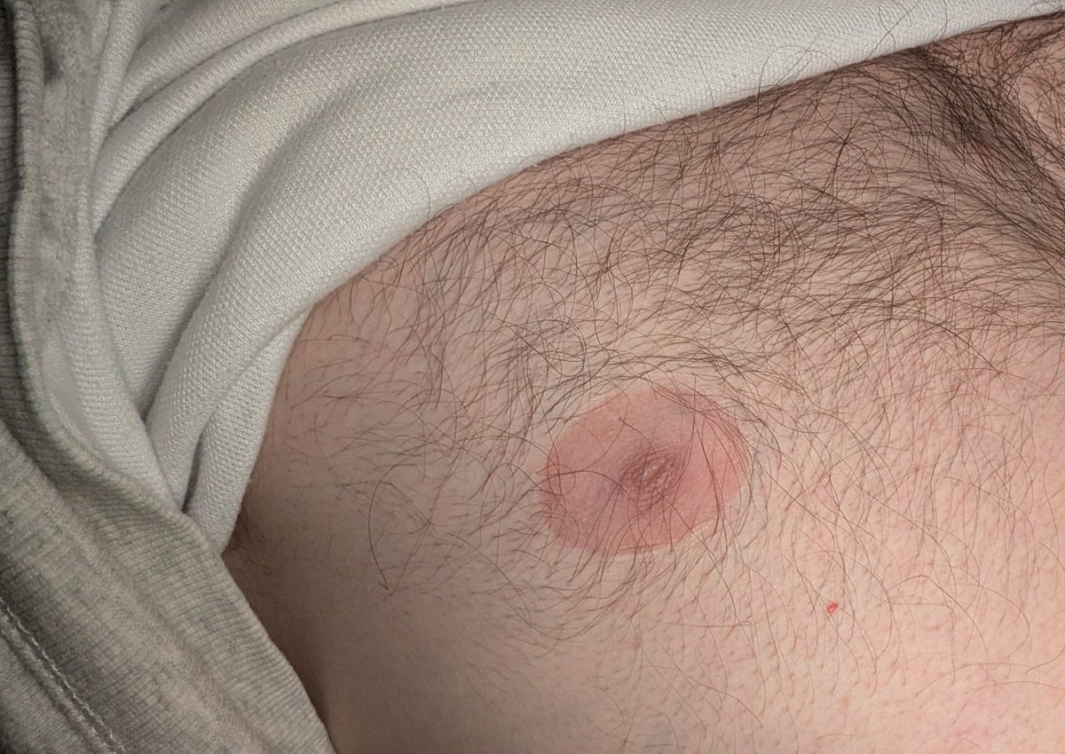 Le Bivouaqueur Fou 🤠 tweet media