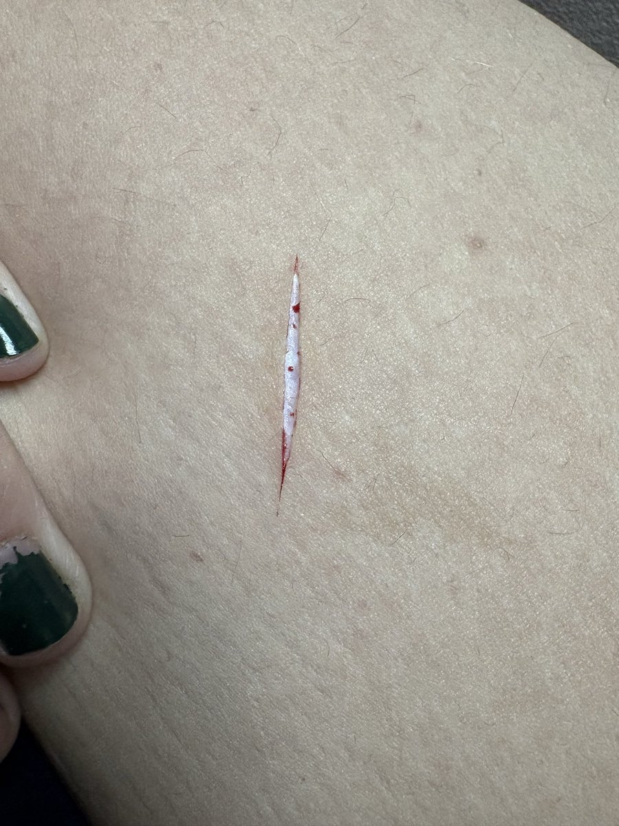 opal 🦷 shedtwt tweet media