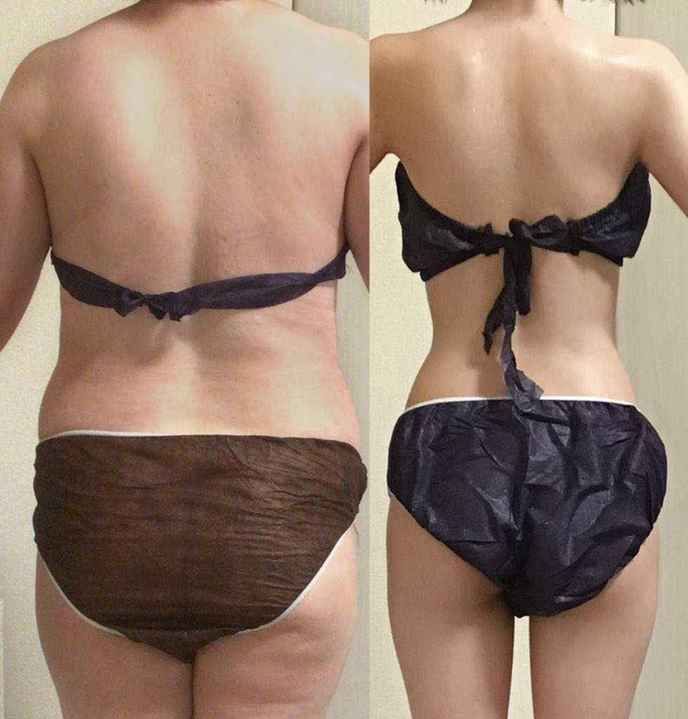 綺麗に痩せるちゃん💋 tweet media