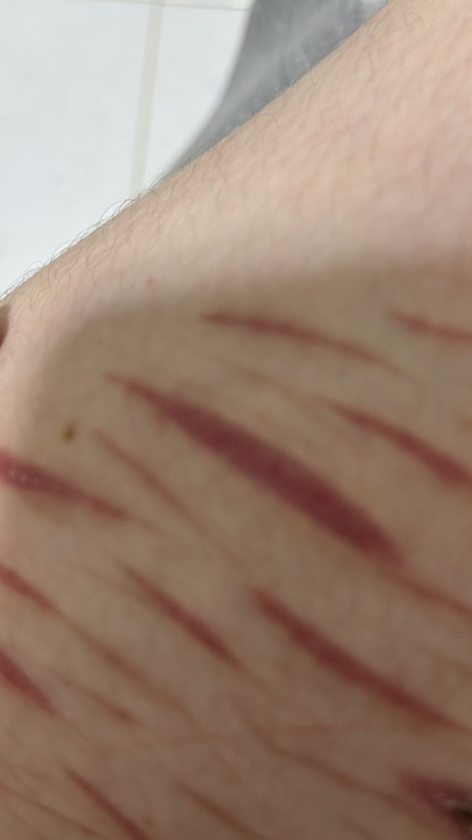 💉raven of shedtwt tweet media