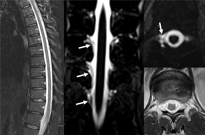 Andrew L Callen MD tweet media