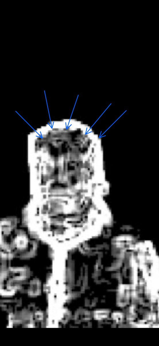 ⓒʜɪʟʟɪɴᴏɪꜱ tweet media