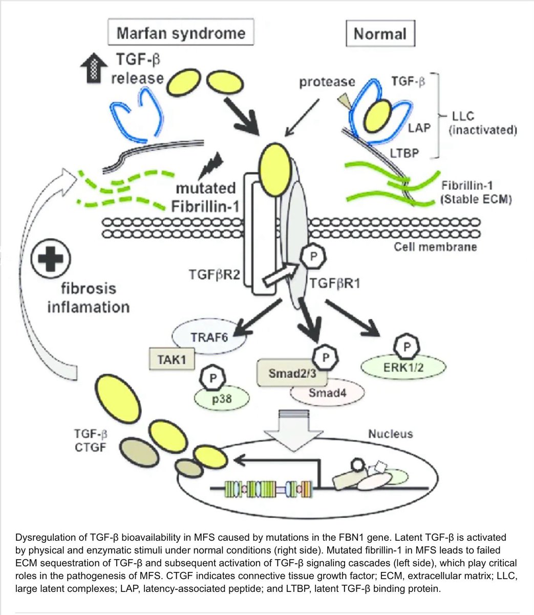 alb_giraldo's tweet image. Angiotensin II receptor blockers (such as losartan) may help slow aortic dilation in #Marfan syndrome by reducing transforming growth factor beta (#TGF𝜷)-signaling and its expression. Although beta-blockers act mainly by reducing hemodynamic stress, it has also been observed
