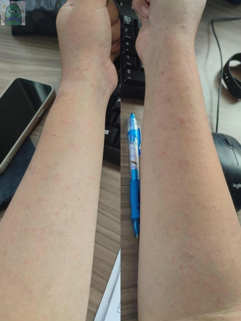 Tanyarlfes tweet media