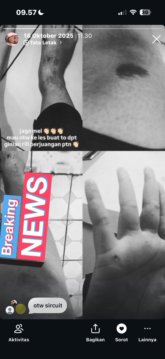 alesha²⁶ tweet media