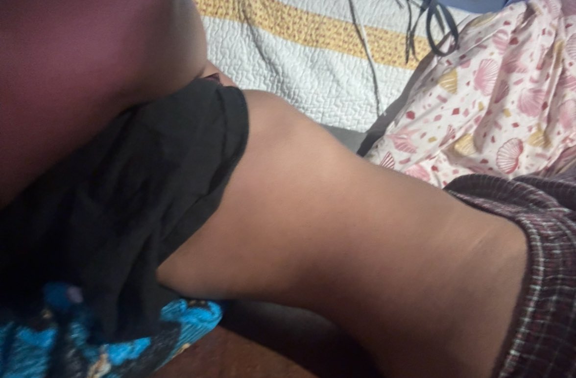 ;) 🌠🧟‍♀️☠️ tweet media