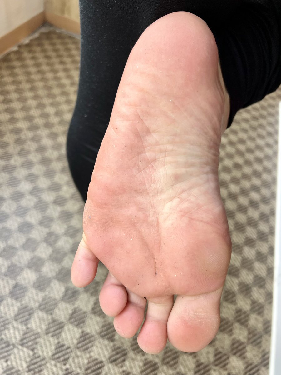 ぴかりん🦶 tweet media